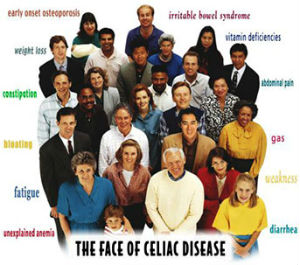 Celiac Disease and effects on teeth for the dentist to identify