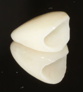 dental crown photo showing a reflection in the mirror
