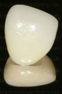 dental crowns from China can contain lead