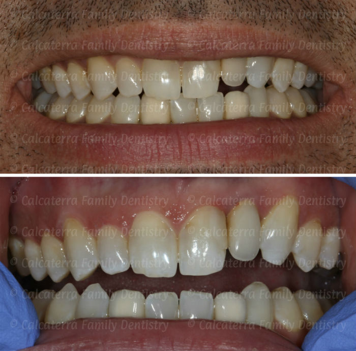 Pre-operative photos of our patient Mark from Orange