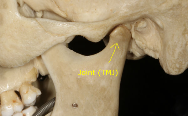 photo of TMJ in a skull which can have pain after opening